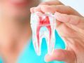 Endodontia
